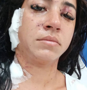 Mulher que levou 34 facadas na Praça Seca só não foi morta porque traficantes intercederam